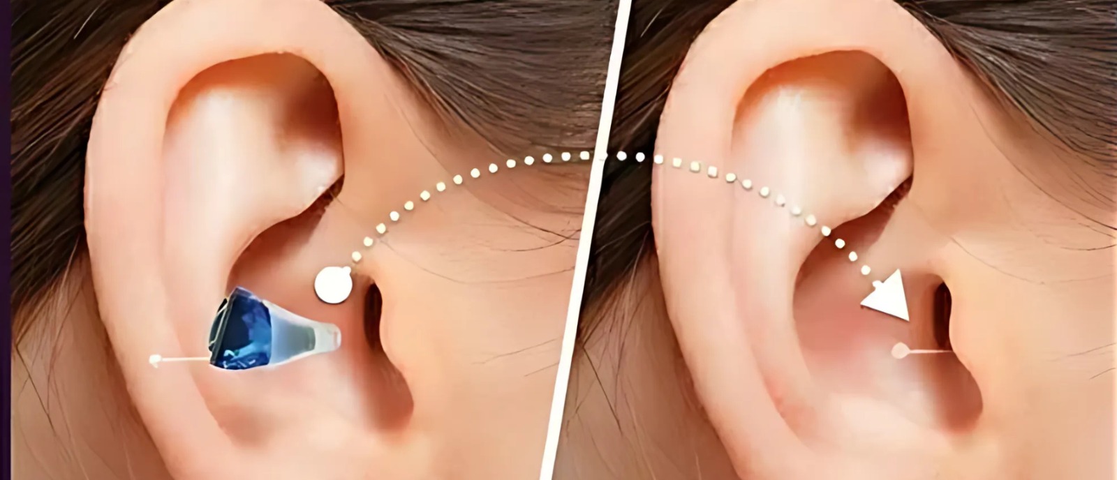 Invisible hearing aids offer custom-fit comfort, molded to your ear canal for discreet hearing help